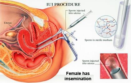 Insemination-img